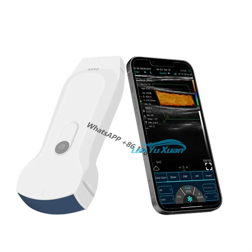 

Wireless Portable Human Ultrasound Machine High Quality 3 In 1 Medical Probe