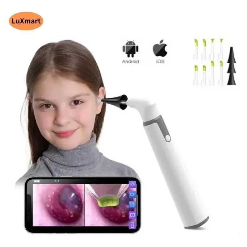 Ear Wax Cleaner Smart WiFi Visible Light Ear Scoop 3.9mm 720P for Mobile Android phone
