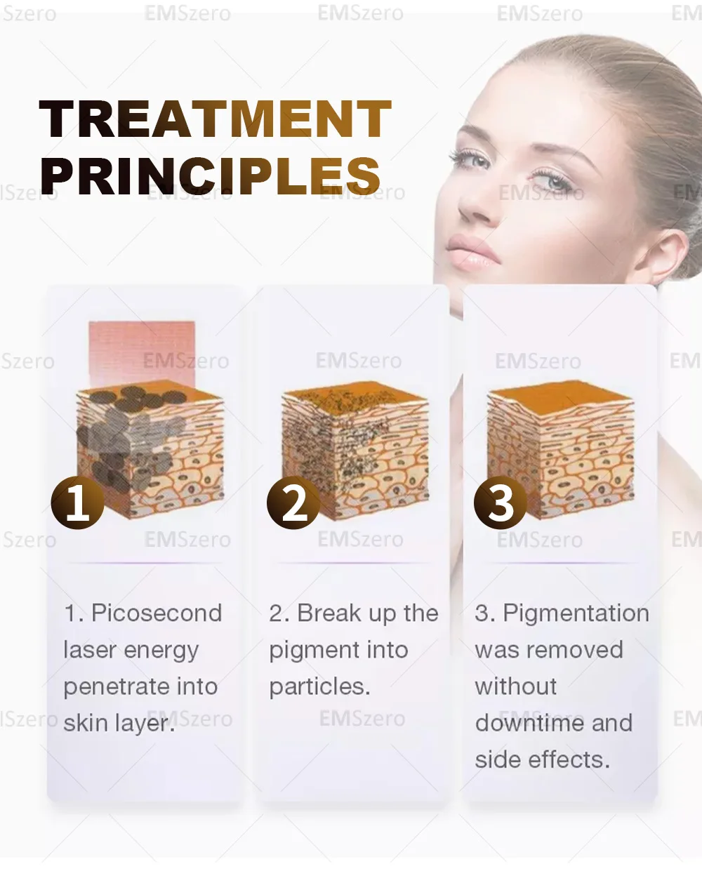 2in1 Soprano Titanium Ice Platinum Diode 755 808 1064nm 3 Wavelength Laser ND:YAG Machine Painless Hair Removal Machine 2025