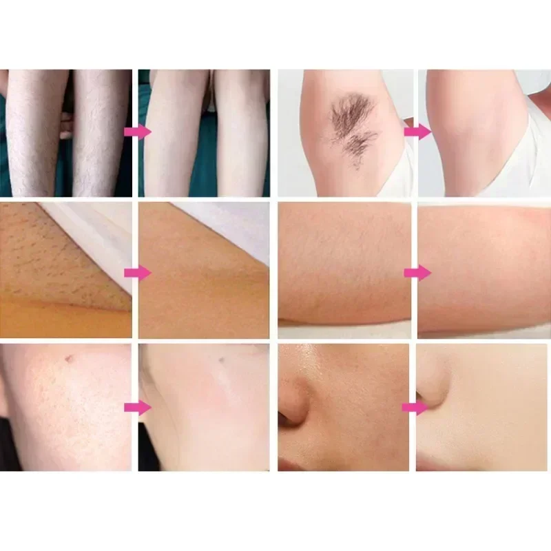 3000W Diode Laser Hair Removal Professional Machine esktop rejuvenation epilator for women Wavelengths 6