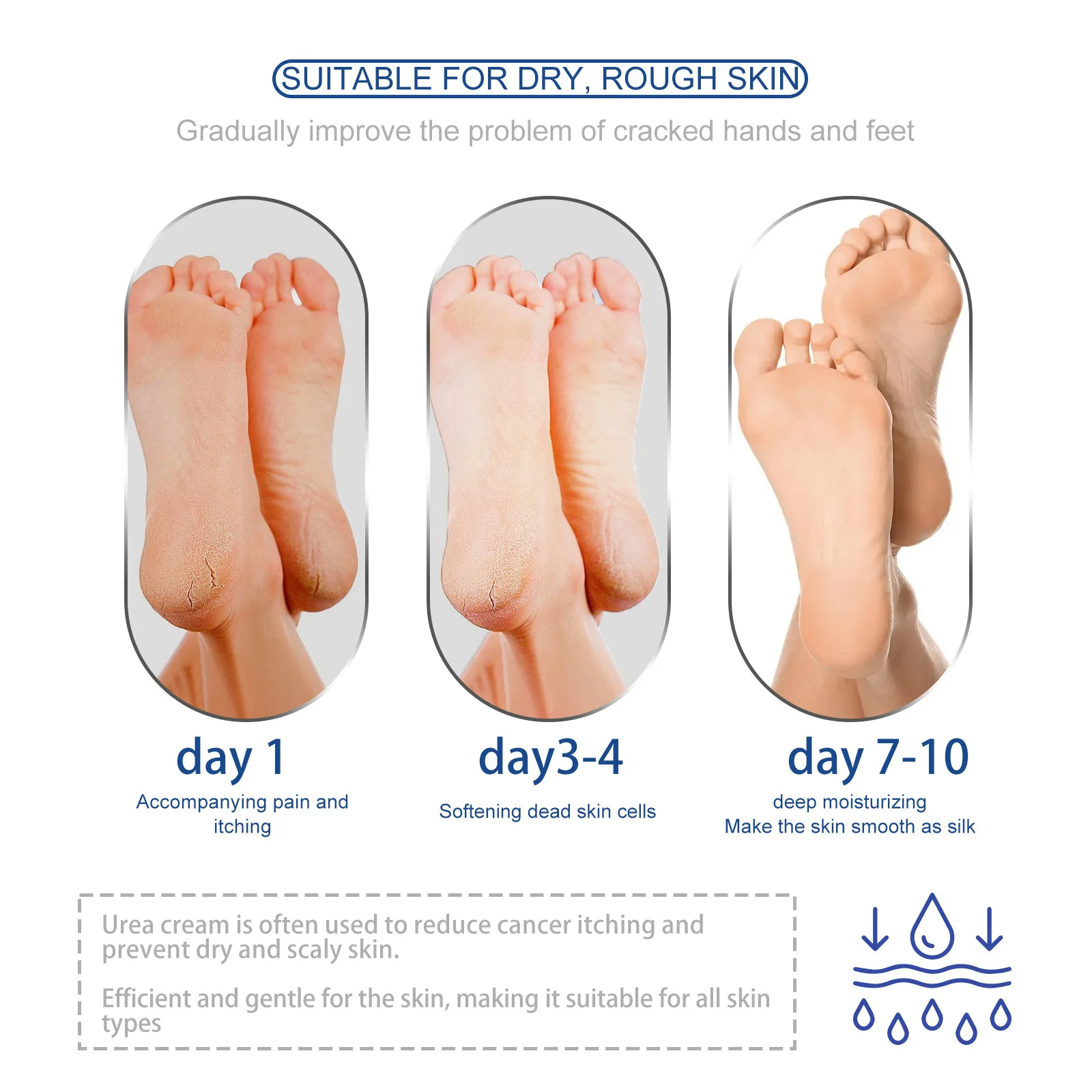 Foot Cream Anti-Drying Cracking Dead Skin Callus Removal Hand Heel Chapped Repair Moisturizing Exfoliating