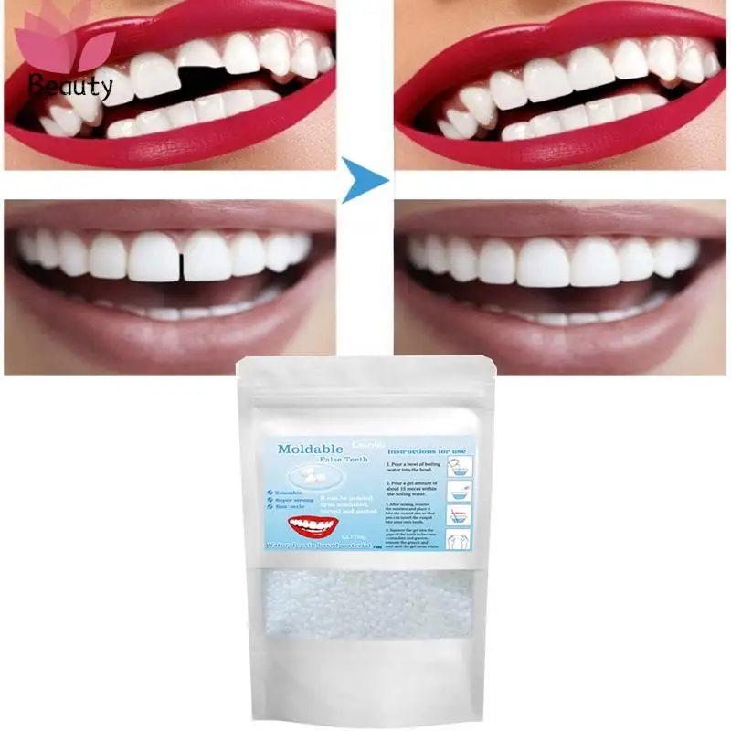 TemporaryFillingTeethRepairMaterialParticlesShapeableDentalGlue