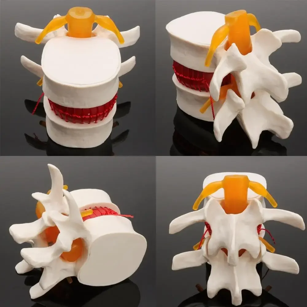 Human Anatomy Skeleton Spine Lumbar Disc Herniation Teaching Model Brain Skull Traumatic Pistol School Supplies Medical Instrument human skull model