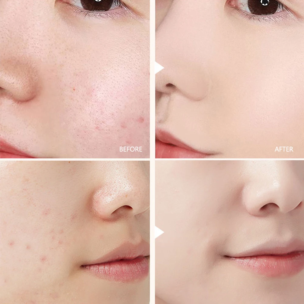 Рисунок 2 - Новая BB крем с гиалуроновой кислотой ампула