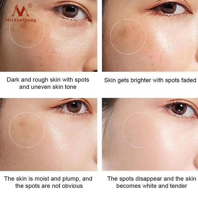 Meiyanqiong Anti Aging Face Care Cream Dark Spot Remover Skin Lightening Cream Dark Skin Care Anti Freckle Whitening Cream 3