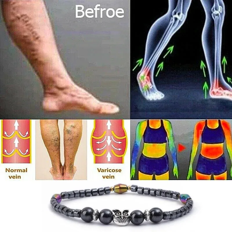 Ankle Chains Molded Slimming Magnetic Therapy Health Magnet Ankle Chains Relieve Fatigue Weight Loss Magnet Anklets Natural Stones Bracelets
