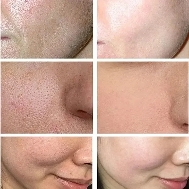 Pore Minimising Essence Refining Skin Reducing Pores Preventing Enlarged Pores Repairing Facial Skin Moisturising Care