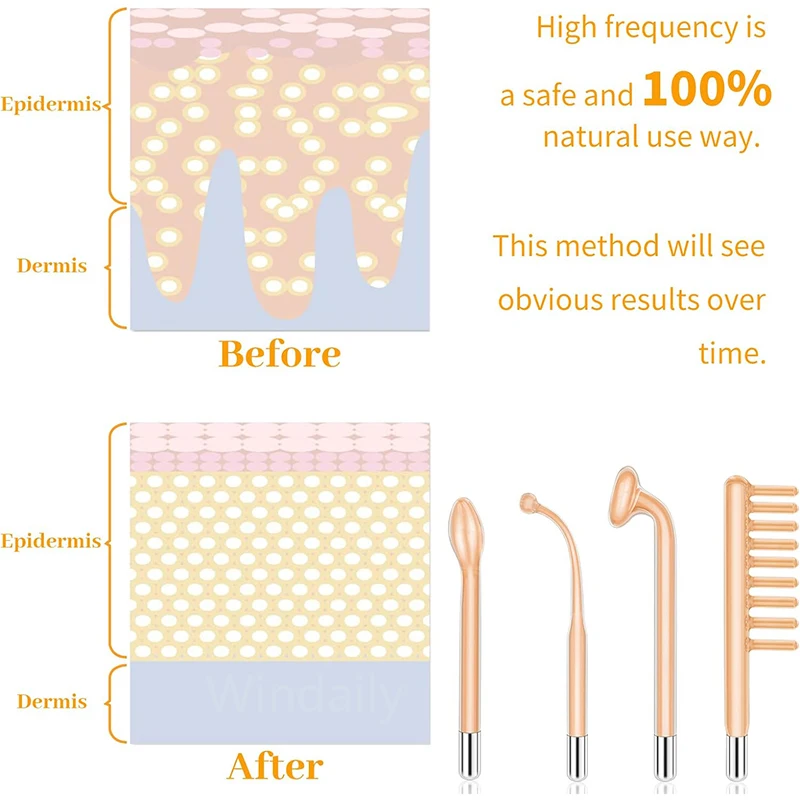 4 in 1 High Frequency Facial Wand Electrotherapy Glass Tube Beauty Device For Anti Aging Wrinkle Removal Facial Therapy Wand