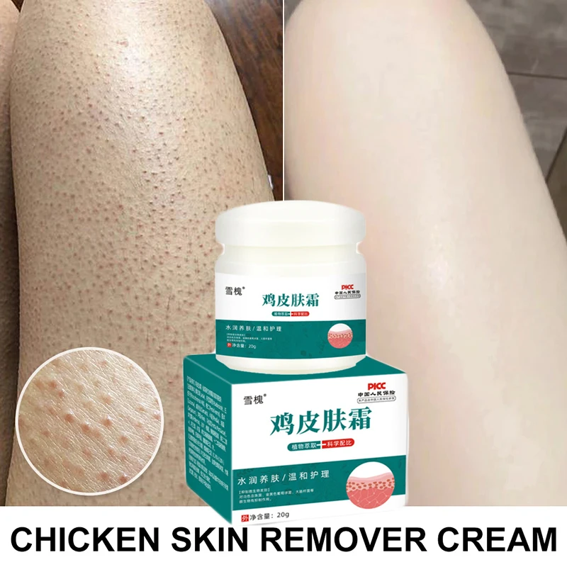 

Remove Chicken Skin Cream Curing Body Dark Spot Keratosis Follicle Pilaris Remove Thick Pore Moisturize Smooth Skin Care Product