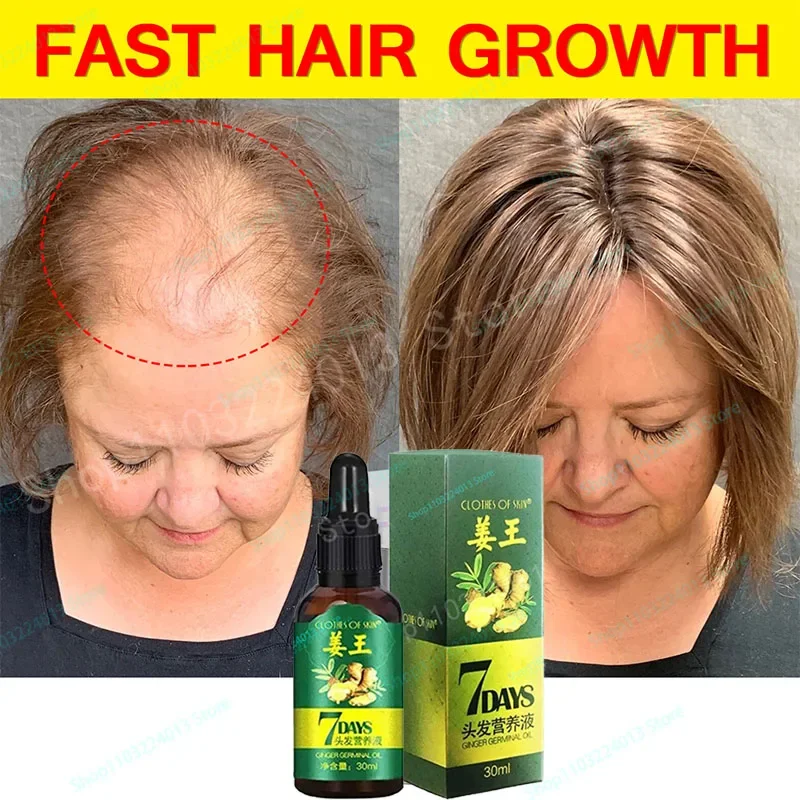 Natural Hair Growth Hair Roots Fast Grow Anti Hair Loss Serum Liquid Scalp Damaged Treatment Repair Beauty Health