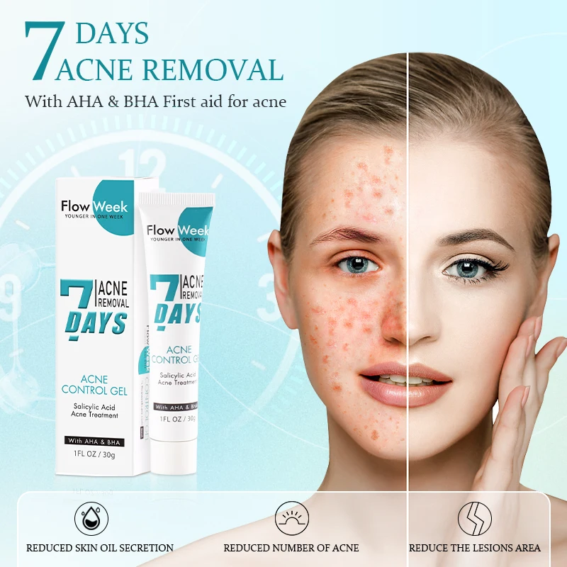 Salicylic Acid Gel Pimple Blackhead Acne Mask Dark Spot Care Shrink Pore Oily Control Skin Care