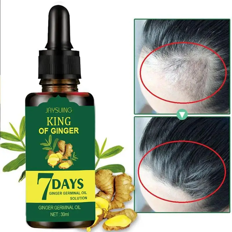 Ginger Essence Hair Loss Treatment Repair Nourish Hair Roots Scalp Care Essence Products For Men Women 30ml