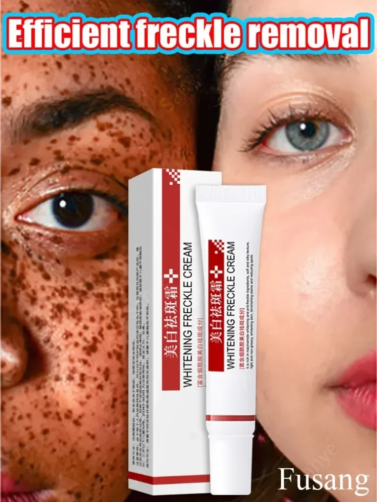 

Highly Effective Freckle Removal Cream Facial Cream for Women To Help Fade Dark Spots and Freckles Brightening Cream for Skin