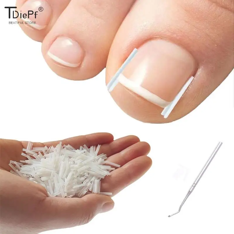 50Pc/box Ingrown Toenail Correction Tool Ingrown Toe Nail Treatment Elastic Patch Sticker Straightening Clip Brace Pedicure Tool