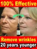 wrinkles disappear become beautiful now