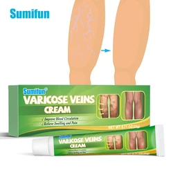 1/2Pcs New Sumifun Varicose Veins Cream Phlebitis Vasculitis Treatment Ointment Smooth Spider Leg Removal Pain Relief Plaster