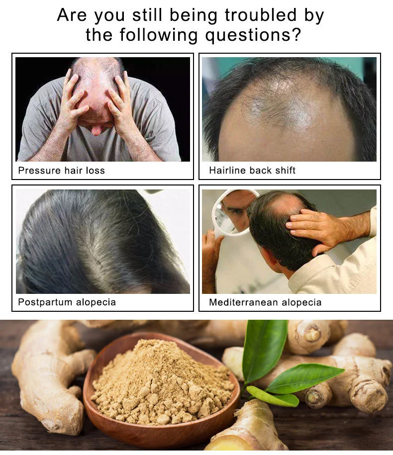Description Picture 4 of itemARTISCARE Hair Loss Growth Spray Hair Oil Keratin Hair treatment Prevent hair Promote hair growth Nouish the scalp Thick Hair