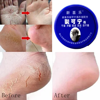 Herbal Anti Crack Foot Cream Oil Anti-Drying Crack Foot Cream Heel Cracked Repair Cream Removal Dead Skin Hand Feet Care Mask 2