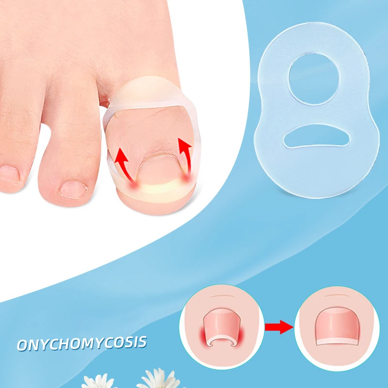 Ingrown Toenail Corrector 2Pcs Silicone Ingrown Toenail Correction Invisible Ingrown Toe Finger Nail Straightening Protector Brace Pedicure Feet Care Tool