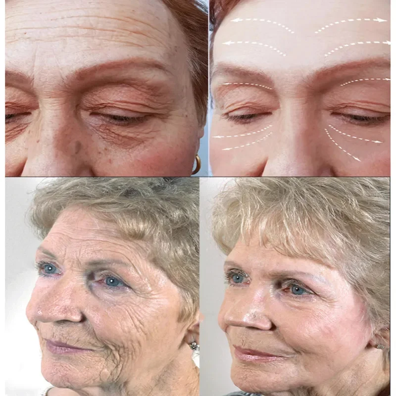 4 IN 1 Remove Wrinkles Face Serum Lifting Firming Fade Fine Lines Anti-Aging Essence Vitamin C Whitening Moist_voghion.com