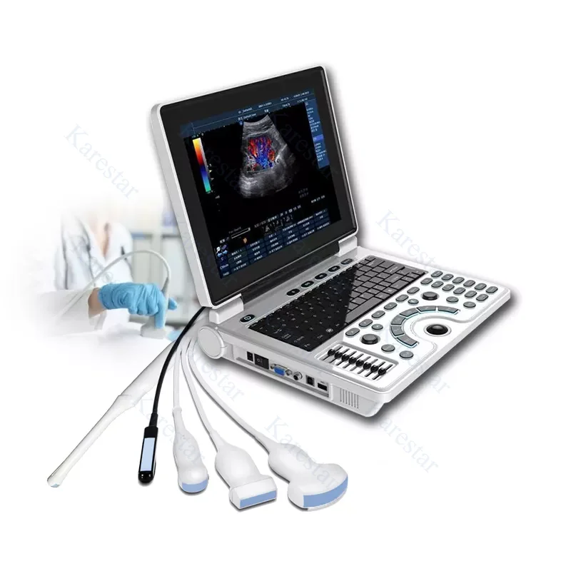 ecografo portatil ultrasound scanner Ecograph Echo Portable Ultrasound