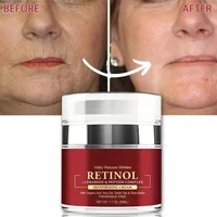 Instant Retinol Cream Wrinkle Remover Firming Lifting Anti Aging Fade Fine Lines Moisturizing Whitening Korea Repair Skin Care 1