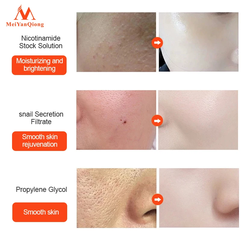 Snail Mucin Essence Pore Shrink Hyaluronic Acid Serum Brighten Moisturizing Nourishing Essence Anti-acne Anti-aging Skin Care