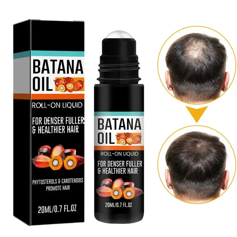 Batana Oil Roller Balls Nourishes hair roots repairs dry and frizzy hair Batana Oil for Hair Growth prevents hair loss