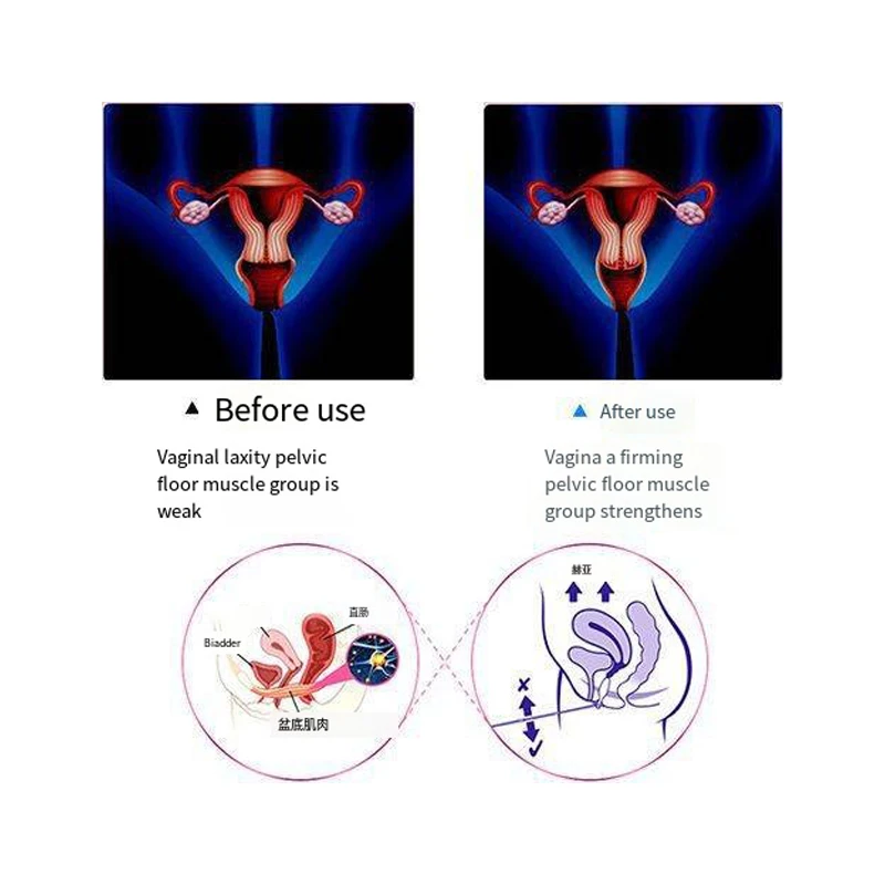 Pelvic Floor Muscle Trainer Exercise Ems Muscle Postpartum Urinary Incontinence Vaginal Contraction Pelvic Floor Muscle - Image 5