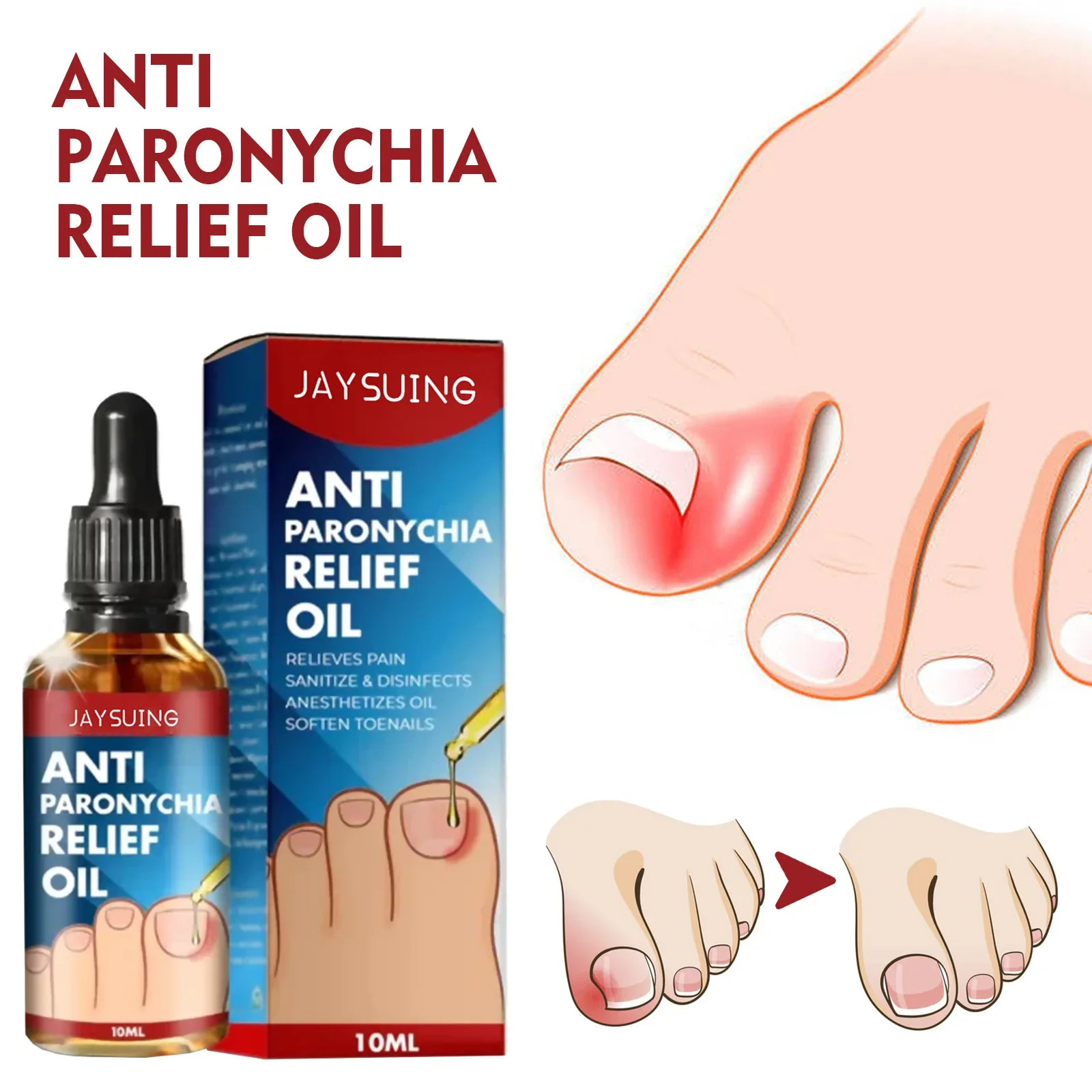 10ml Paronychial Sulcus Nursing Oil Repair Ingrown Armor Grey Nails Paronychial Sulcus Relieve Soft Armor Bright 발톱무좀