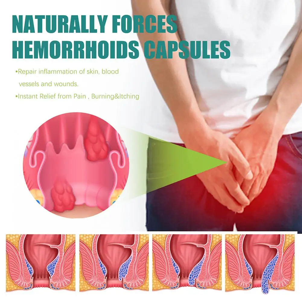 Hemorrhoids Capsules Repair Anal Treatment Internal Mixed External Hemorrhoid Piles Removal Relieve Fissure Pain 7pcs hemorrhoids treatment cream