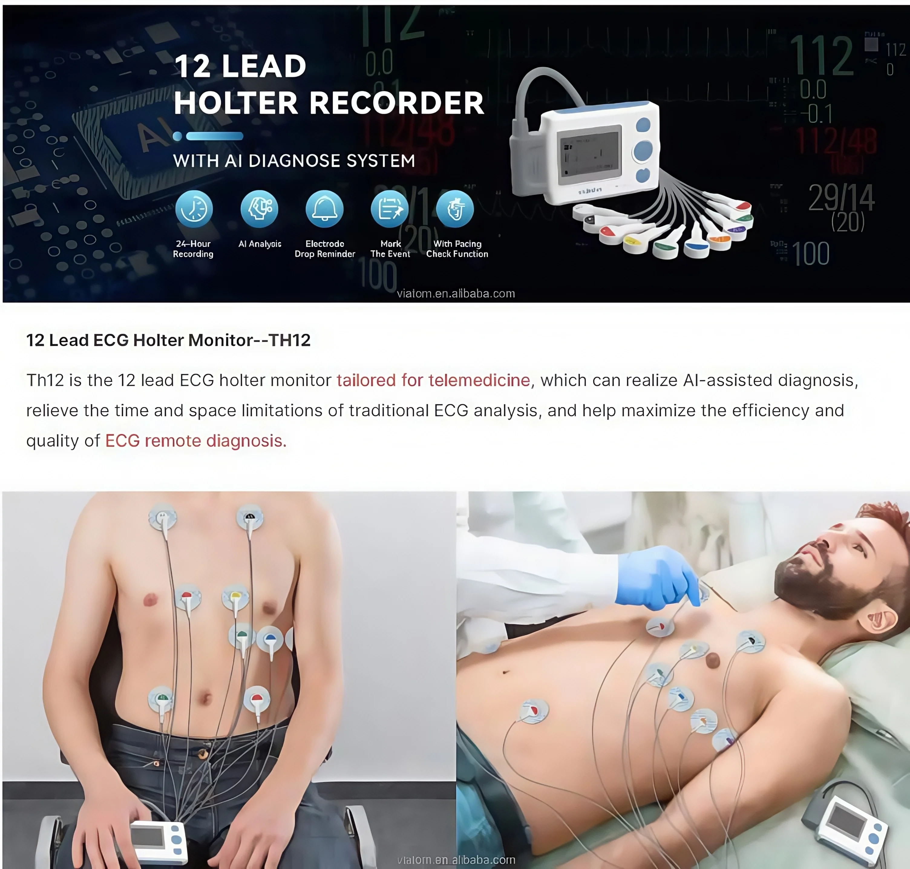 Bluetooth electrocardiogram monitor 12 lead dynamic electrocardiogram 24-hour monitoring heart data storage ma