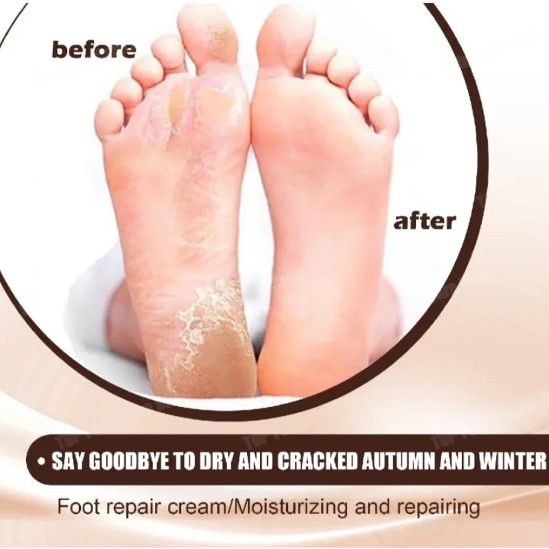Advanced Repair Hand Cream For Dry Cracked Hands Luxury Moisturizing Nourishing Repairing Natural Lotion Horse Oil Skin Cream