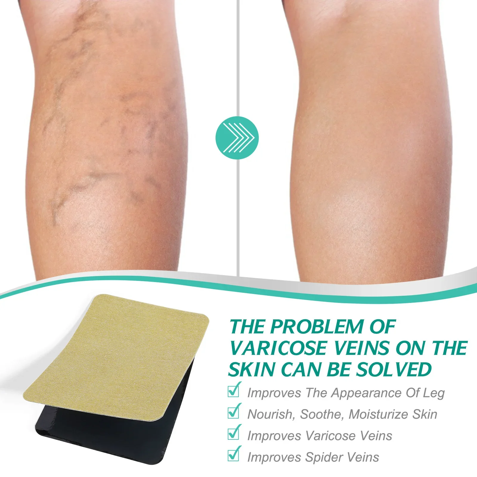 8 PCS Varicose Veins Patch Treatment For Varicose Veins Vasculitis Phlebitis Spider Leg Medical Patch Angiitis Removal