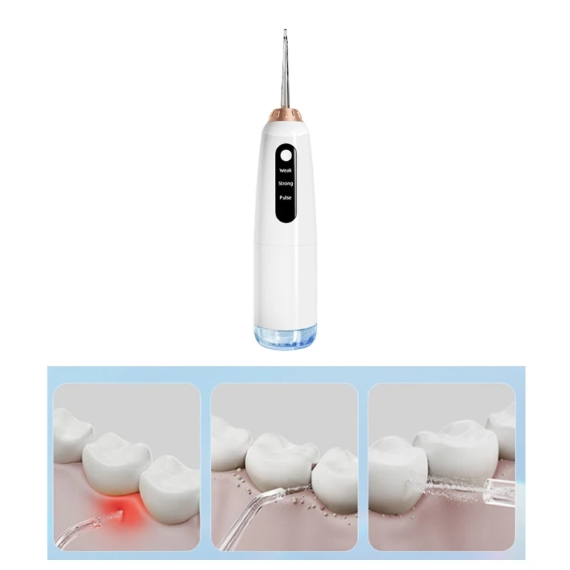 Portable Cordless Dental  Irrigator with 5 Water Pressure Settings and 300ml Reservoir IPX7 Waterproof Water New Dropship