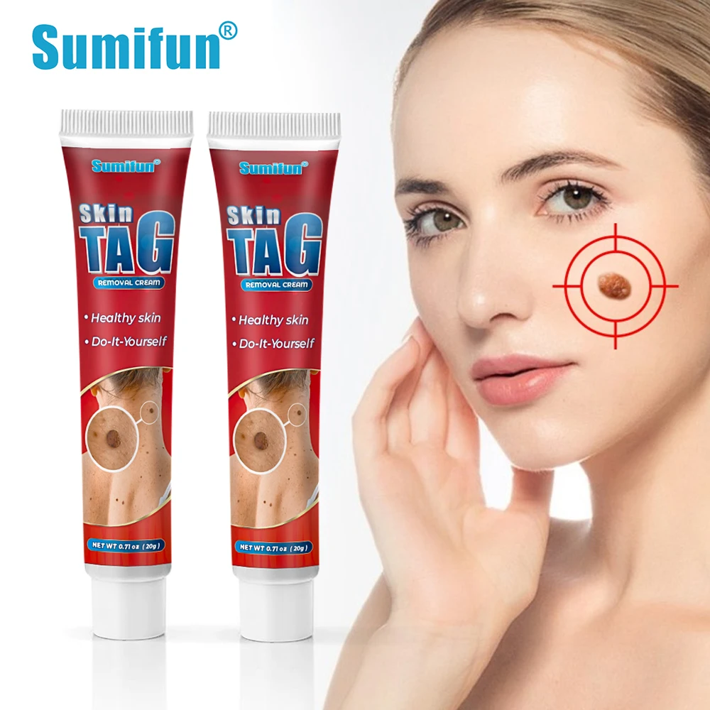 

Sumifun 20g Wart Remover Ointment Face Genital Warts Sharps Cream Body Skin Tag Mole Papilloma Removal Skin Care Beauty Health