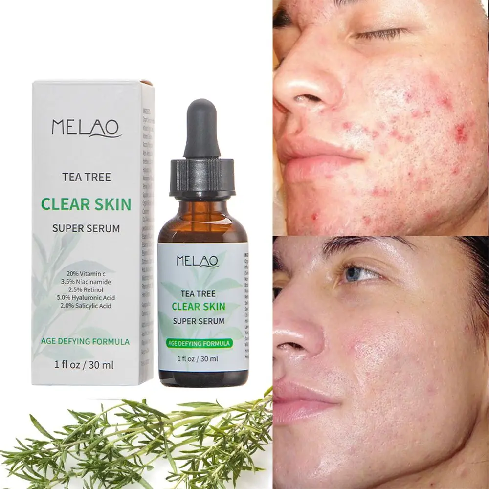 

Natural Tea Tree Liquid Face Serum Acne Essence Lightening Fine Lines Shrink Pores Moisturizing Oil Control Face Skin Care 30ml