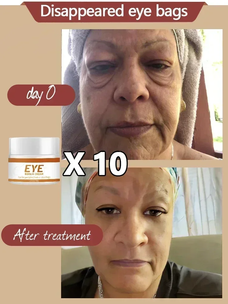 Anti Wrinkle Eye Cream Eye Cream For Eye Care Improving Eye Swelling And Dark Circles