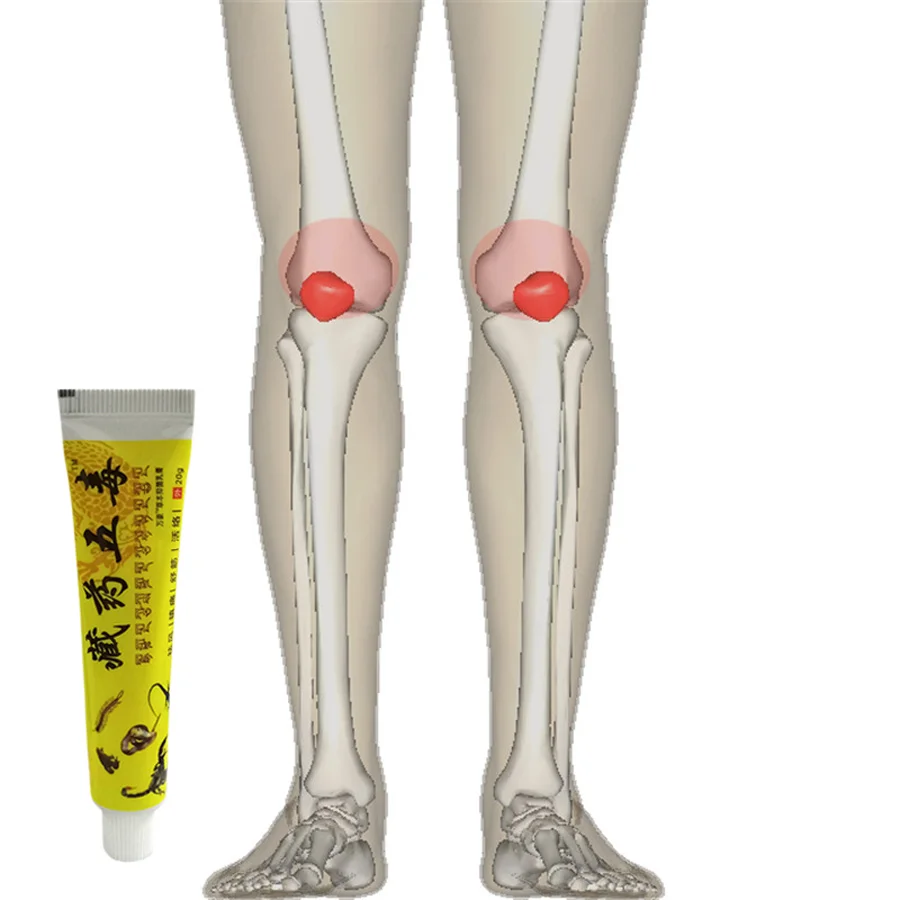 

Ортопедический бальзам для снятия симптомов боли в коленях