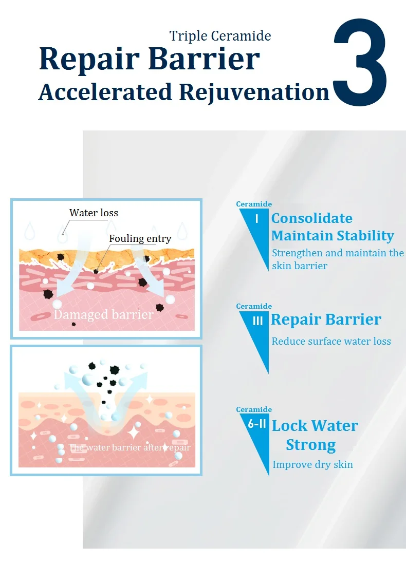 CeraVe SA Lotion for Rough Bumpy Skin Vitamin D Hyaluronic Acid Lactic
