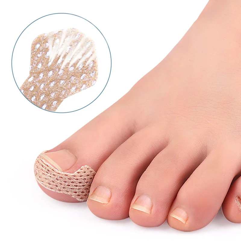40/100pcs Nail Correction Stickers Ingrown Toenail Corrector Patches Treatment Recover Corrector Pedicure Care Tool 3