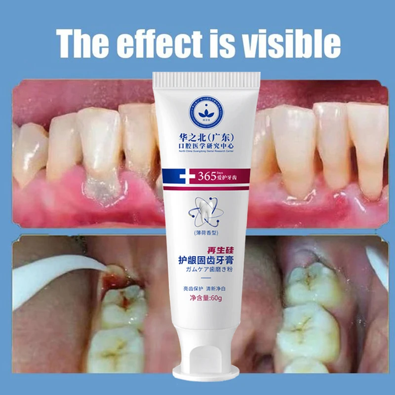 New Upgrade Quick Repair of Cavities Caries Removal of Plaque Stains Decay Whitening Yellowing Repair Teeth Teeth Whitening 5