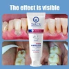 New Upgrade Quick Repair of Cavities Caries Removal of Plaque Stains Decay Whitening Yellowing Repair Teeth Teeth Whitening 5