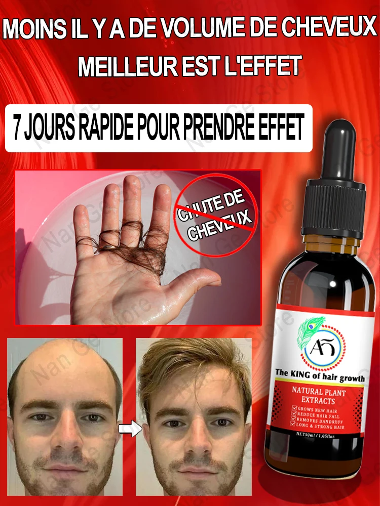 CroissanceinjustedescheveuxHuileanticalvitieCroissancerapide