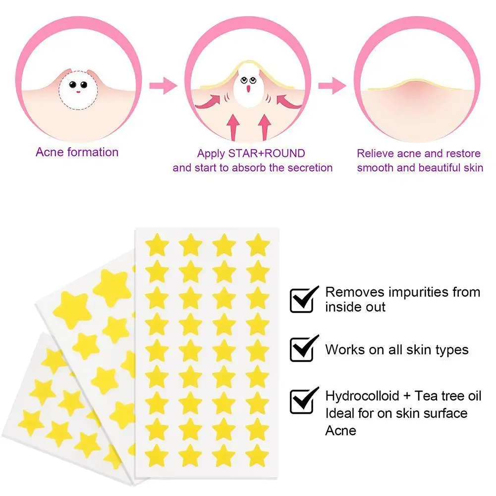 Star Pimple Patch Acne Removal Skin Care Stickers  Originality Concealer Face Spot Beauty Makeup Tool