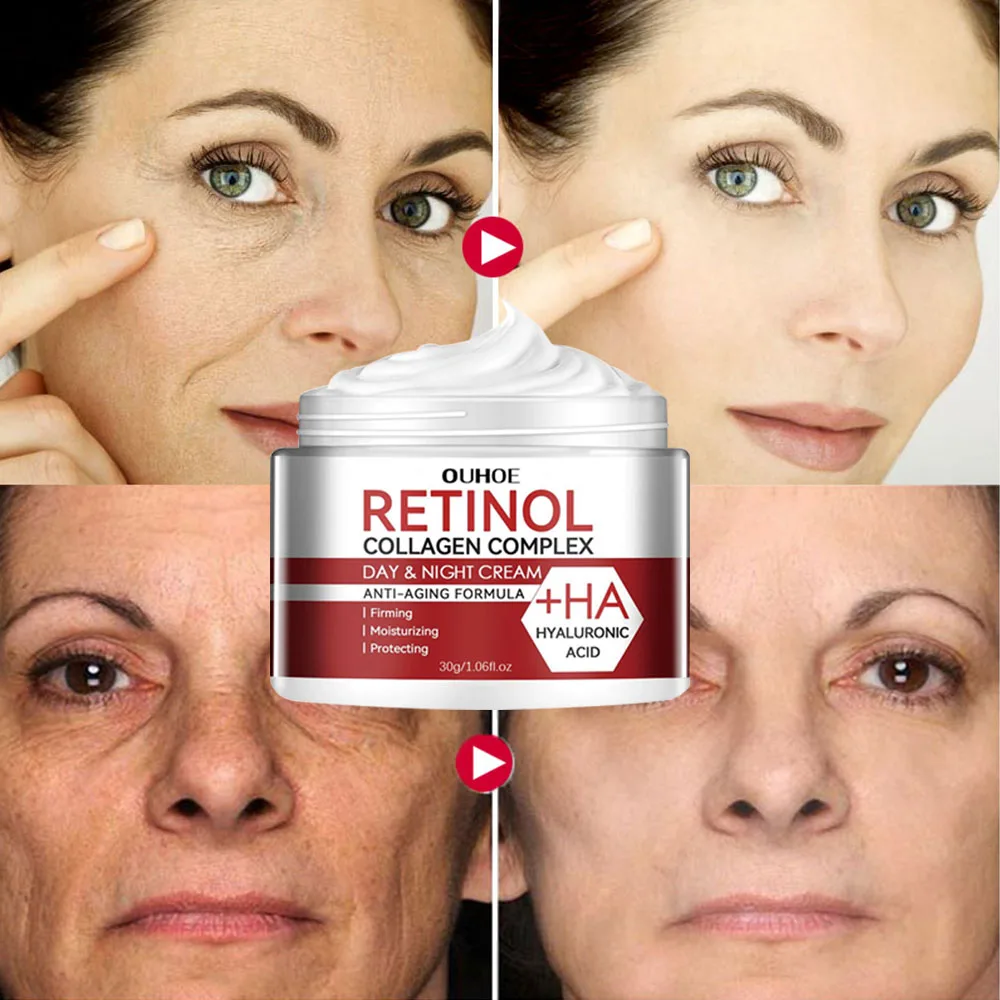 Retinol Lifting Uppstramande ansiktskräm Ta bort rynkor Anti-aging blekna Fina linjer Fuktighetskräm Ljusande hudvård Koreansk_voghion.com