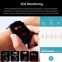 2025 New AI Diagnosis Blood Lipids Uric Acid Body composition Test Smart Watch For Men ECG+PPG Bluetooth Call Health Smartwatch - Image 5