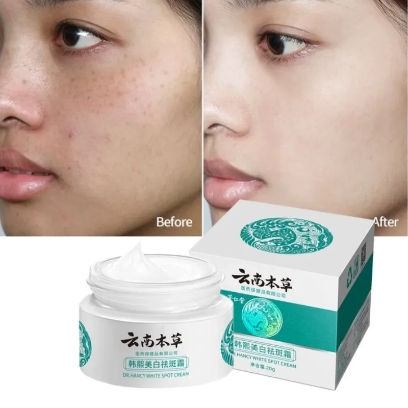 Whitening Spot Cream Anti Aging Face Cream Skin Care Freckles Cream Remove Melanin and Black Spots Skin Fade Spots Moisturizing remove dark lip balm pink lip gloss oil lighten black smoke lip exfoliate dead skin whitening anti crack moisturize lip care mak