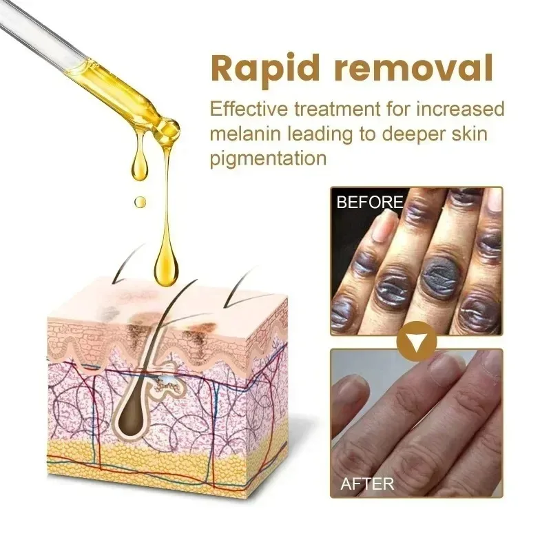Brightening Serum Bleaching Moisturizing Underarm Knuckles Knee Inner Thigh Wh-itening Cream Removal Dark-Spots Lighten Dullness 4
