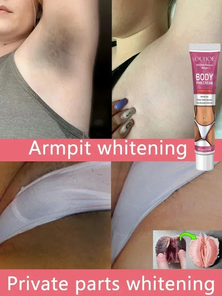 Inner Thigh Bleaching Cream Intimate Area Lightening Emulsion Butt Private Parts Brightening Cream Women Knuckles Bleach Serum 5